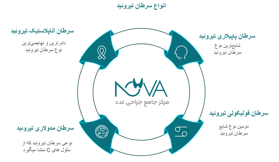 اینفوگرافیک انواع سرطان تیروئید