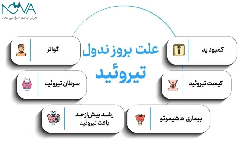 علل ایجاد ندول تیروئید