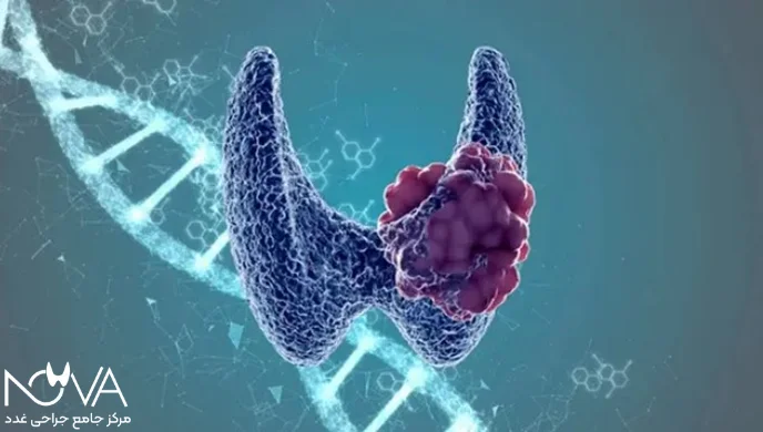 رشد غیر طبیعی سلول های تیروئید منجر به ایجاد ندول می شود.