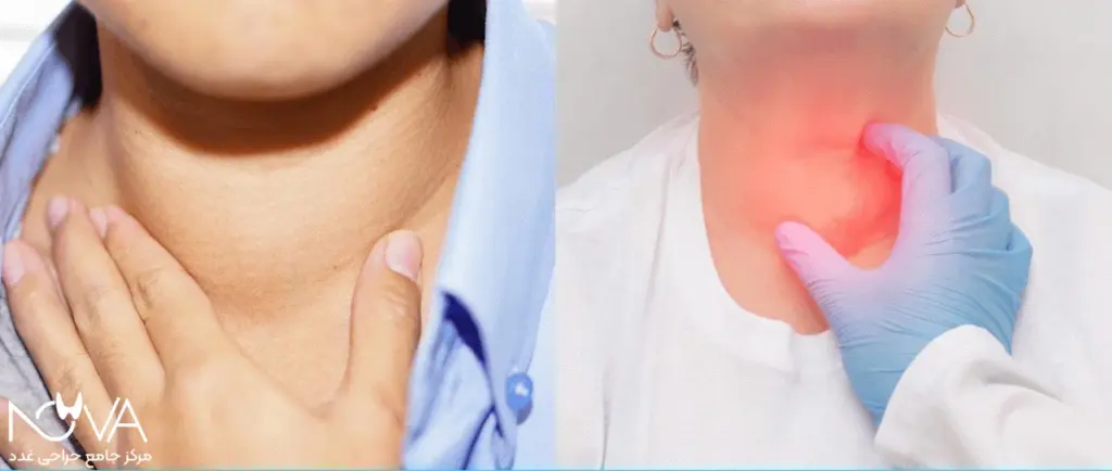 نحوه تشخیص سرطان تیروئید را نشان می‌دهد.