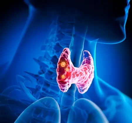 نووا کلینیک جراحی غدد