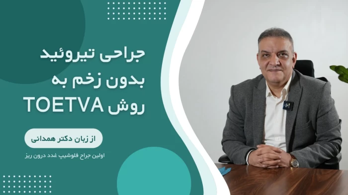جراحی تیروئید بدون زخم به روش TOETVA