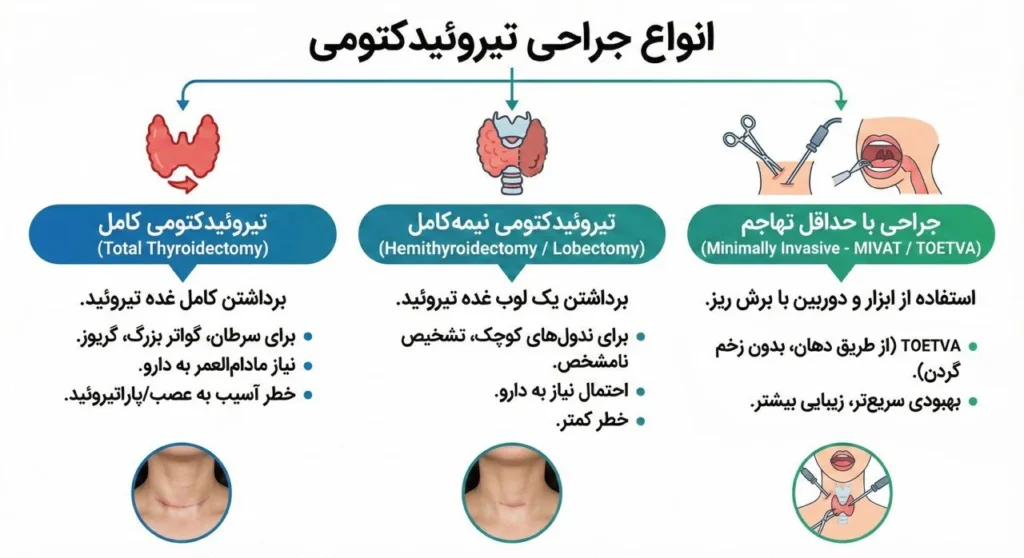 اینفوگرافیک انواع جراحی تیروئیدکتومی