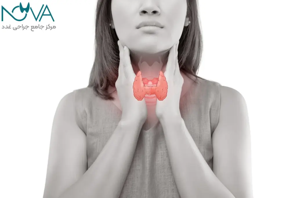 مراحل جراحی تیروئید هاشیموتو