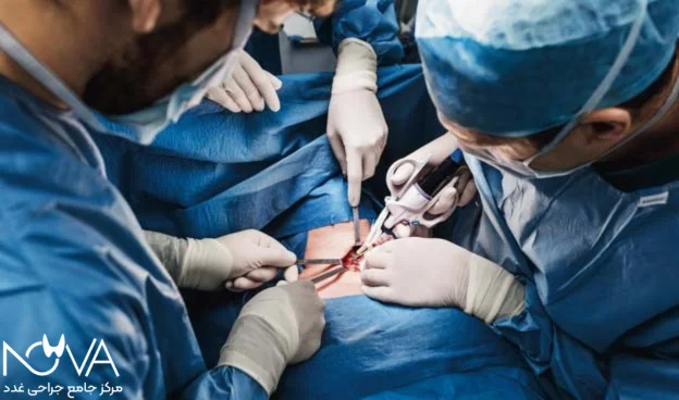 دستمزد جراح برای جراحی تیروئید