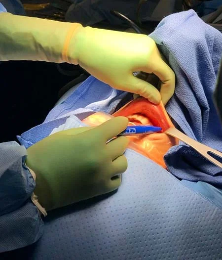 هزینه جراحی تیروئیدکتومی