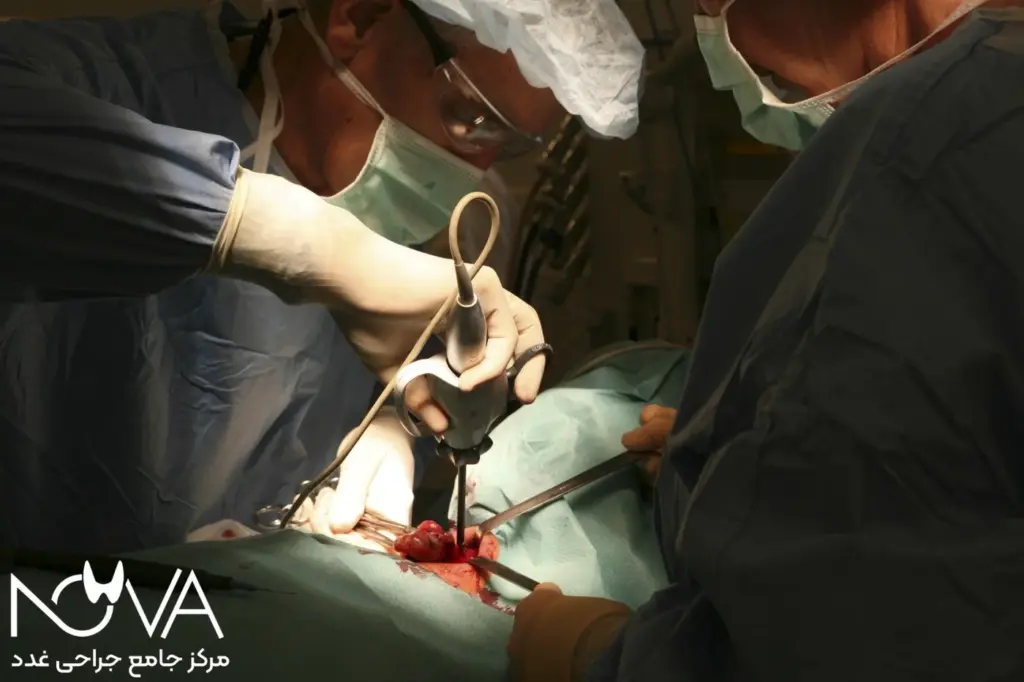 آشنایی با جراحی تیروئید هاشیموتو