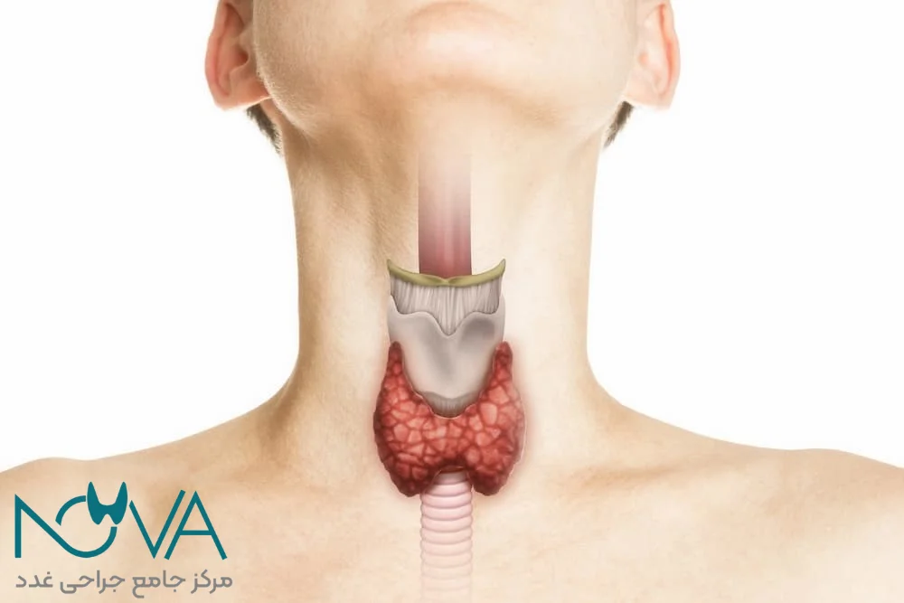 آزمایشات لازم برای تشخیص کیست تیروئید