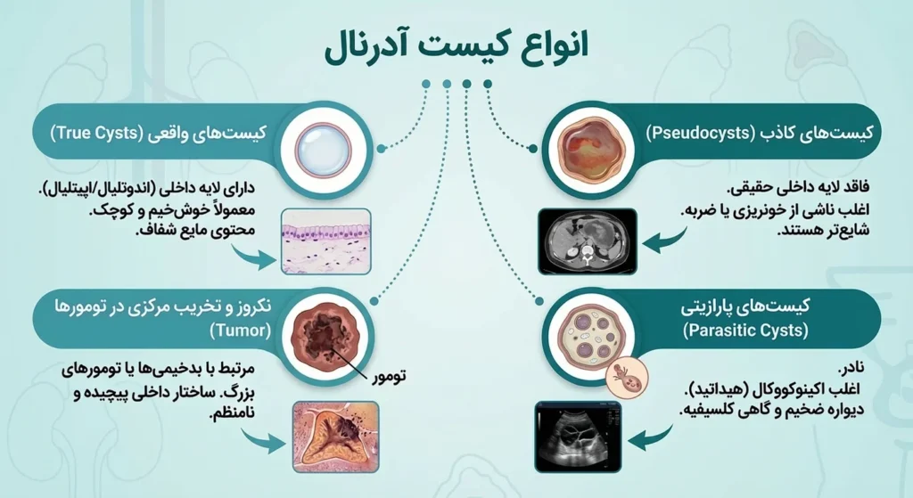 انواع کیست آدرنال