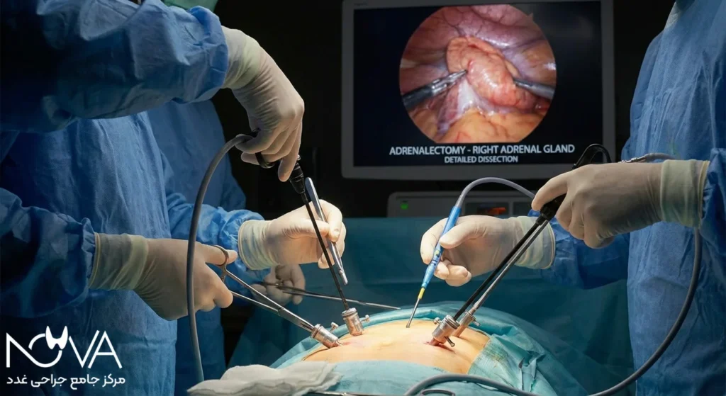 ارزیابی توده آدرنال